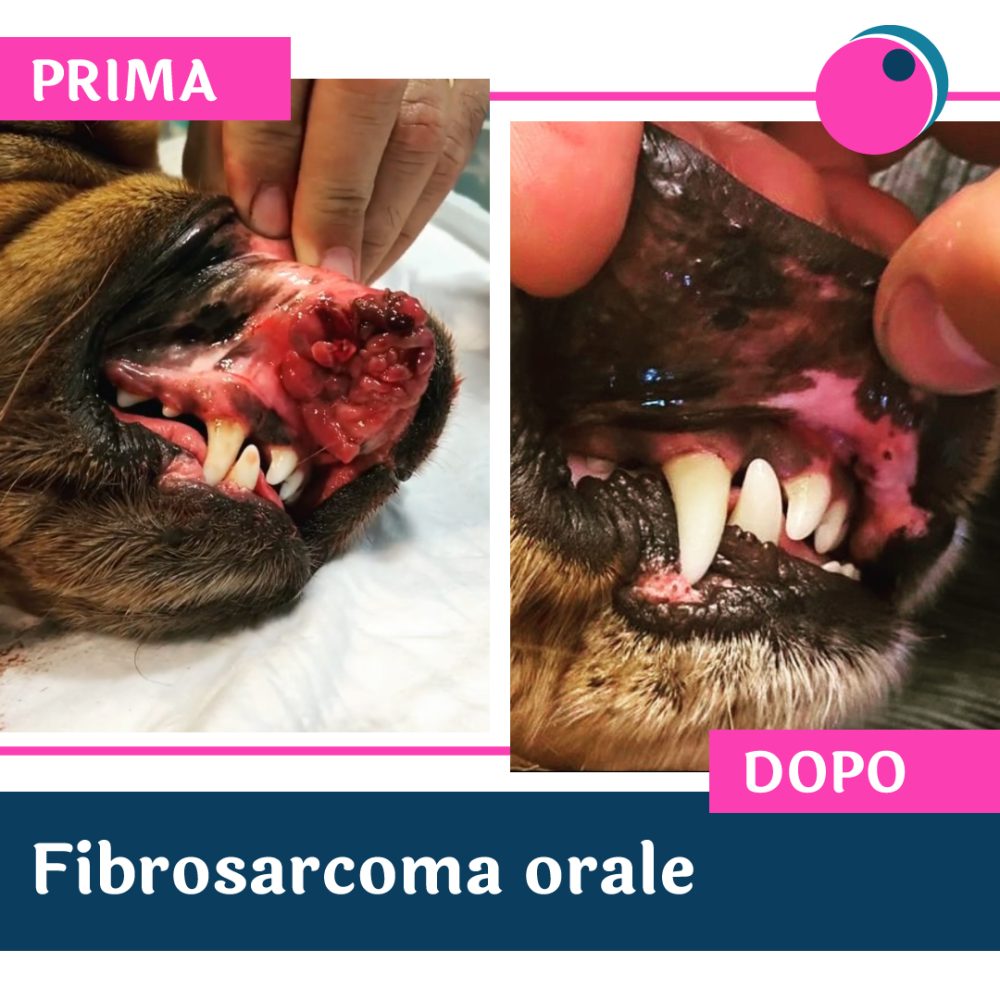 Fibrosarcoma-orale